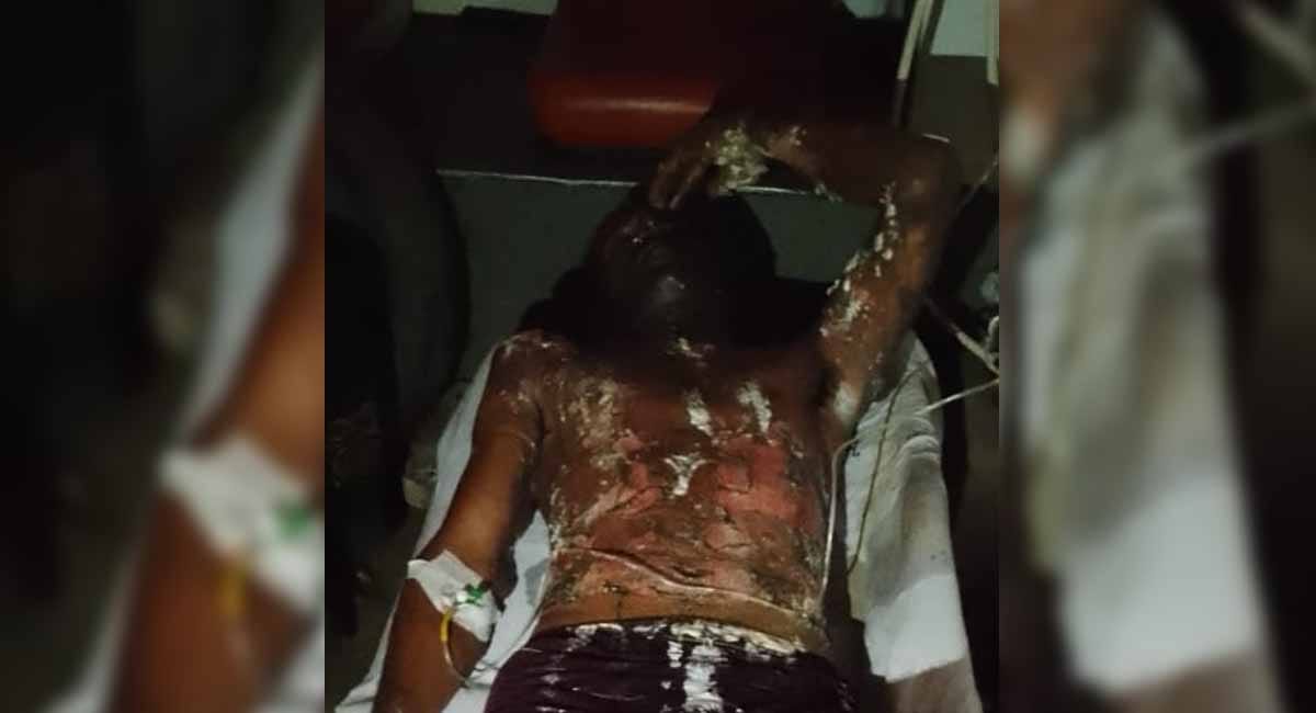 αñåαñù αñ╕αÑç αñ¥αÑüαñ▓αñ╕αÑç αñ»αÑüαñ╡αñò αñòαÑÇ αñ«αÑîαññ, αñåαñ░αñòαÑìαñ╖αñò αñ¬αñ░ αñ¬αÑçαñƒαÑìαñ░αÑïαñ▓ αñíαñ╛αñ▓αñòαñ░ αñåαñù αñ▓αñùαñ╛αñ¿αÑç αñòαñ╛ αñåαñ░αÑïαñ¬