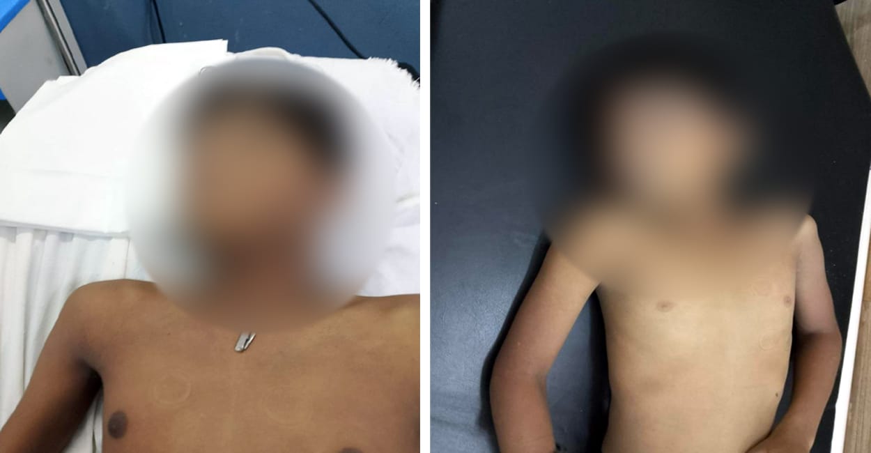 αñ¬αñ╛αñ¿αÑÇ αñ╕αÑç αñ¡αñ░αÑç αñùαñíαÑìαñóαÑç αñ«αÑçαñé αñíαÑéαñ¼αñòαñ░ αñªαÑï αñ¼αñÜαÑìαñÜαÑïαñé αñòαÑÇ αñ«αÑîαññ- αñàαñ¿αÑìαñ» αñ¼αñ┐αñéαñªαÑüαñôαñé αñ¬αñ░ αñ¬αÑüαñ▓αñ┐αñ╕ αñ£αñ╛αñéαñÜ αñ«αÑçαñé αñ£αÑüαñƒαÑÇ 