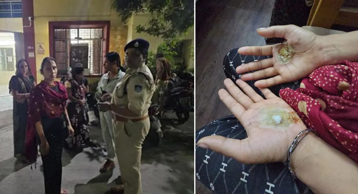 αñ«αñ╣αñ┐αñ▓αñ╛ αñòαÑç αñ«αñ╛αñÑαÑç αñ¬αñ░ αñÜαñ┐αñ¬αñòαñ╛αñ»αñ╛ αñùαñ░αÑìαñ« αñ╕αñ┐αñòαÑìαñòαñ╛, 'αñ¡αÑéαññ' αñ¿αñ┐αñòαñ╛αñ▓αñ¿αÑç αñòαÑç αñ▓αñ┐αñÅ αñÿαñéαñƒαÑïαñé αñªαÑÇ αñ»αñ╛αññαñ¿αñ╛, αñ£αñ╛αñ¿αñ┐αñÅ αñ¬αÑéαñ░αñ╛ αñ«αñ╛αñ«αñ▓αñ╛ 